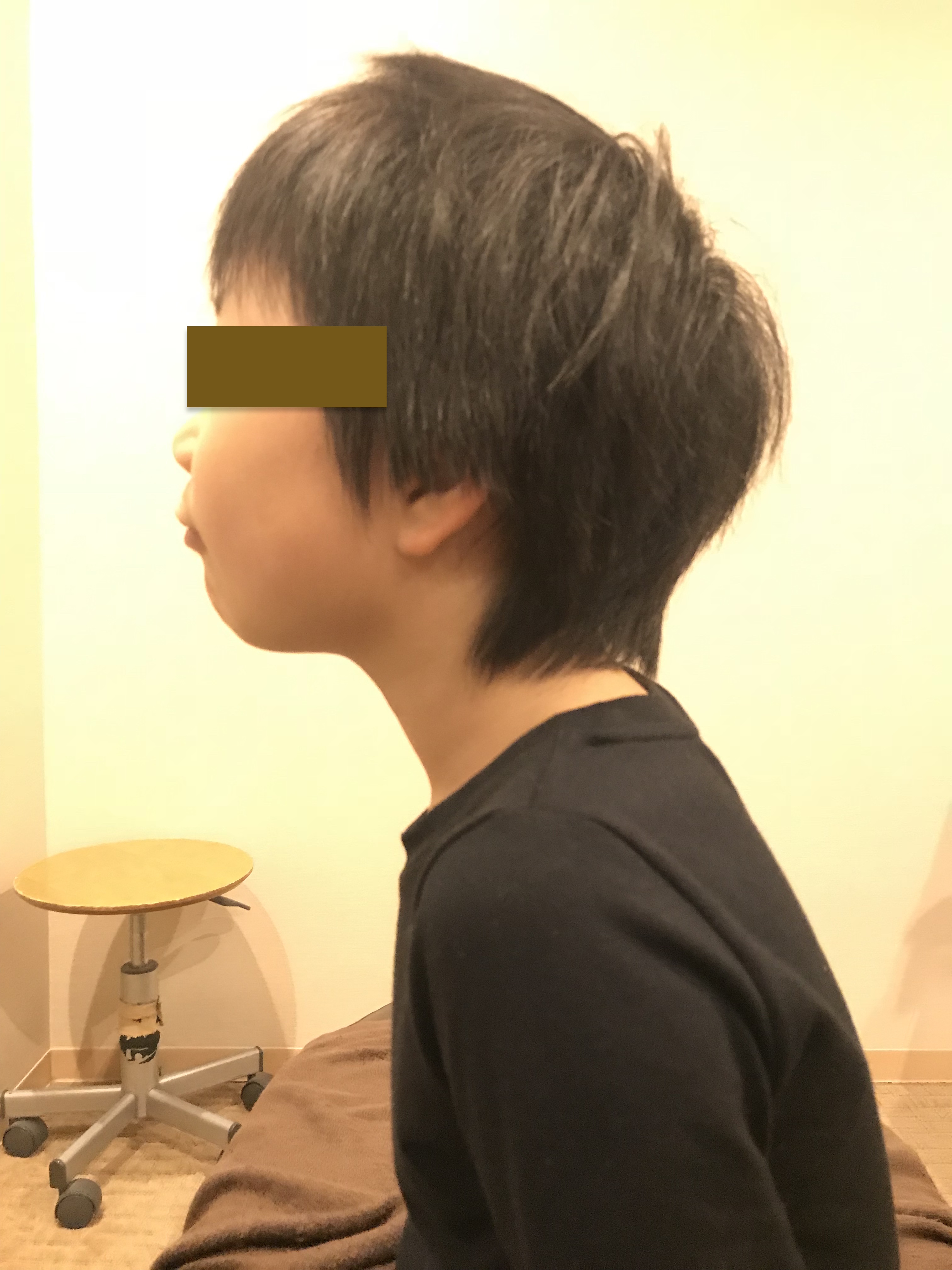 子供の首寝違えから考える 姿勢の大きな問題