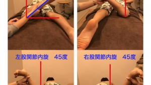 内股歩行研究（セルフ検査法②）